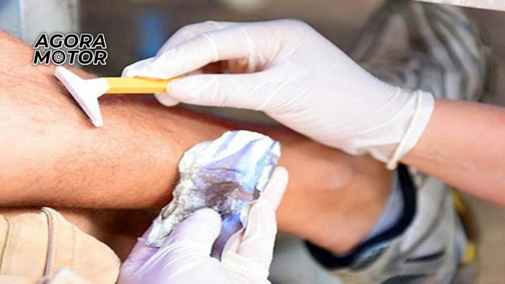 Foto do Exame Toxicológico Detran 2022 coleta de pelos